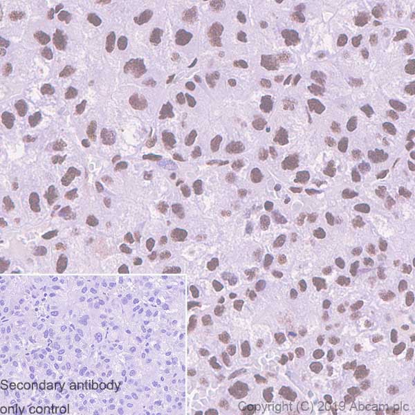 Immunohistochemistry (Formalin/PFA-fixed paraffin-embedded sections) - Anti-EWSR1/EWS antibody [EPR4647] (AB133288)