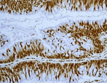 Immunohistochemistry (Formalin/PFA-fixed paraffin-embedded sections) - Anti-EWSR1/EWS antibody [EPR4647] (AB133288)