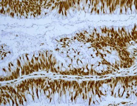 Immunohistochemistry (Formalin/PFA-fixed paraffin-embedded sections) - Anti-EWSR1/EWS antibody [EPR4647] (AB133288)