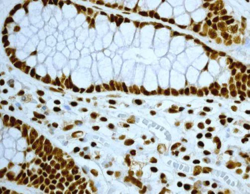 Immunohistochemistry (Formalin/PFA-fixed paraffin-embedded sections) - Anti-EWSR1/EWS antibody [EPR4647] - BSA and Azide free (AB240055)