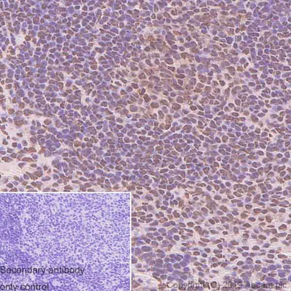 Immunohistochemistry (Formalin/PFA-fixed paraffin-embedded sections) - Anti-EWSR1/EWS antibody [EPR4647] - BSA and Azide free (AB240055)