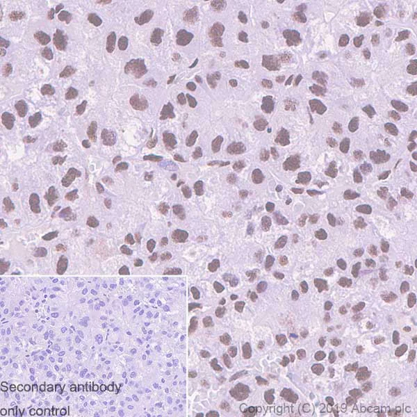 Immunohistochemistry (Formalin/PFA-fixed paraffin-embedded sections) - Anti-EWSR1/EWS antibody [EPR4647] - BSA and Azide free (AB240055)