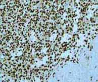 Immunohistochemistry (Formalin/PFA-fixed paraffin-embedded sections) - Anti-EWSR1/EWS antibody [EPR4648] (AB133318)