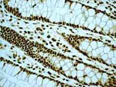 Immunohistochemistry (Formalin/PFA-fixed paraffin-embedded sections) - Anti-EWSR1/EWS antibody [EPR4648] - BSA and Azide free (AB248470)