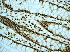 Immunohistochemistry (Formalin/PFA-fixed paraffin-embedded sections) - Anti-EWSR1/EWS antibody [EPR4648] - BSA and Azide free (AB248470)