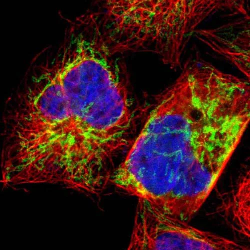 Immunocytochemistry/ Immunofluorescence - Anti-EXD2 antibody (AB121236)
