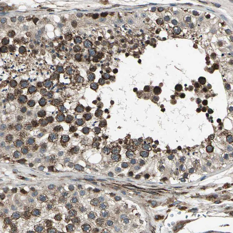 Immunohistochemistry (Formalin/PFA-fixed paraffin-embedded sections) - Anti-EXD2 antibody (AB121236)