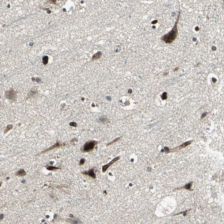 Immunohistochemistry (Formalin/PFA-fixed paraffin-embedded sections) - Anti-EXD2 antibody (AB121236)