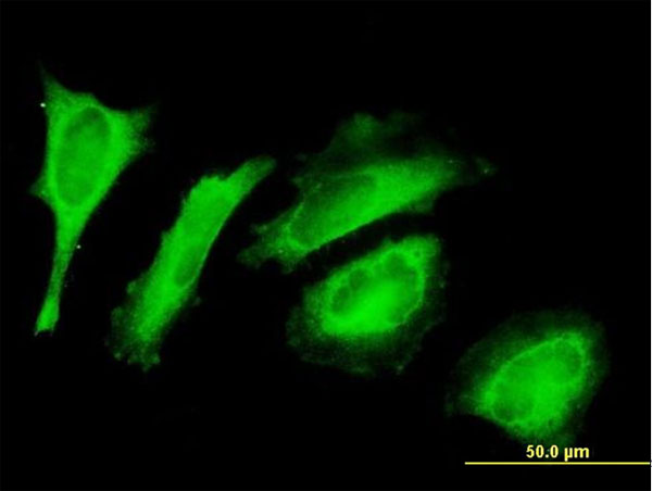 Immunocytochemistry/ Immunofluorescence - Anti-EXD2 antibody (AB169672)