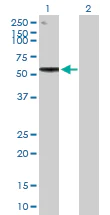 Western blot - Anti-EXD2 antibody (AB169672)