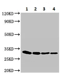 Western blot - Anti-Exfoliative Toxin A/ETA antibody (AB225679)