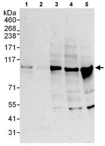 Western blot - Anti-EXOC1 antibody (AB118798)