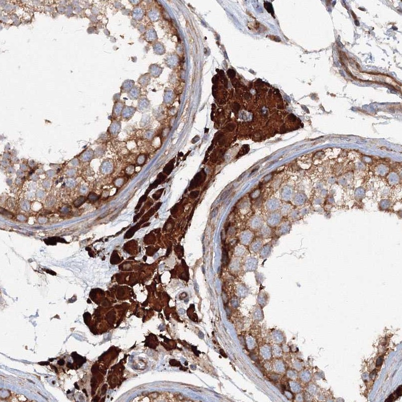 Immunohistochemistry (Formalin/PFA-fixed paraffin-embedded sections) - Anti-EXOC1 antibody (AB251853)