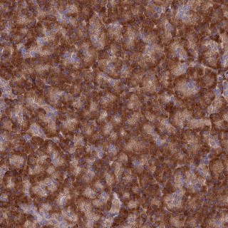 Immunohistochemistry (Formalin/PFA-fixed paraffin-embedded sections) - Anti-EXOC3L4 antibody (AB126345)