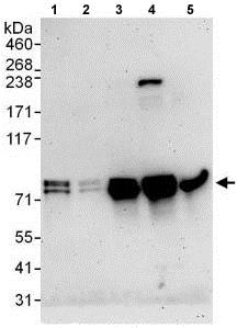 Western blot - Anti-EXOC7 antibody (AB118792)