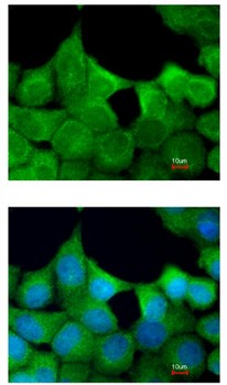 Immunocytochemistry/ Immunofluorescence - Anti-EXOC7 antibody (AB95981)