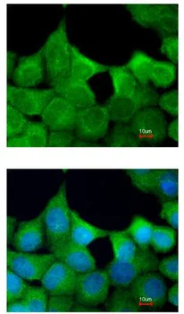 Immunocytochemistry/ Immunofluorescence - Anti-EXOC7 antibody (AB95981)