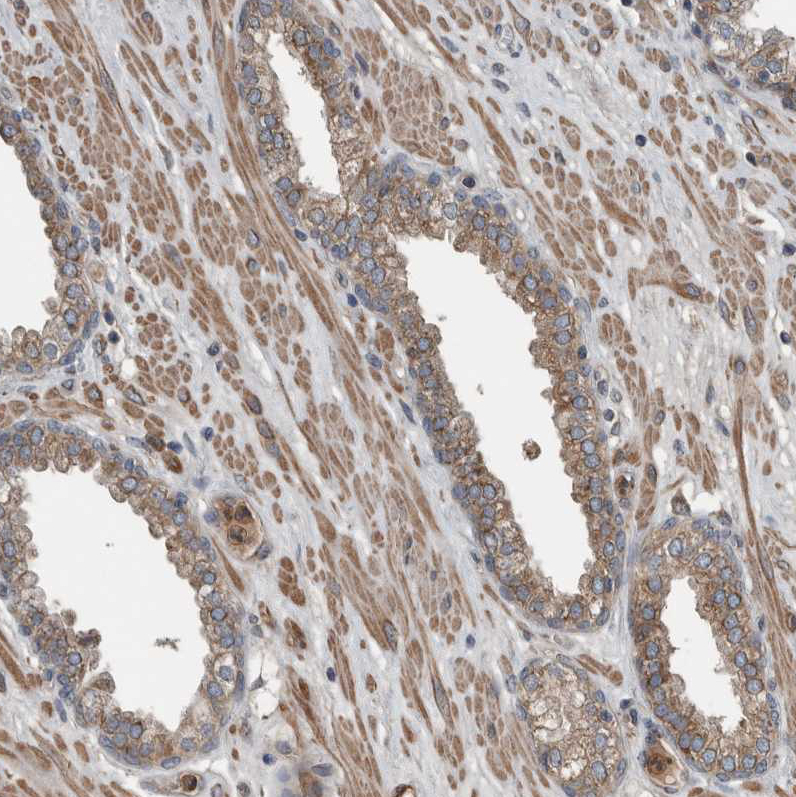 Immunohistochemistry (Formalin/PFA-fixed paraffin-embedded sections) - Anti-EXOC8 antibody (AB254804)