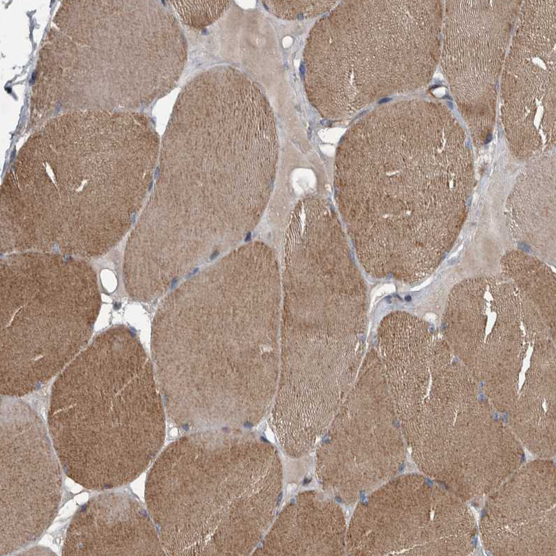 Immunohistochemistry (Formalin/PFA-fixed paraffin-embedded sections) - Anti-EXOC8 antibody (AB254804)