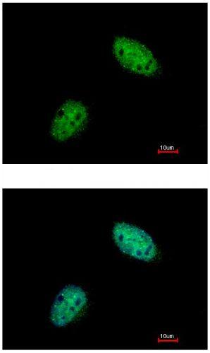 Immunocytochemistry/ Immunofluorescence - Anti-Exonuclease 1 antibody (AB155553)