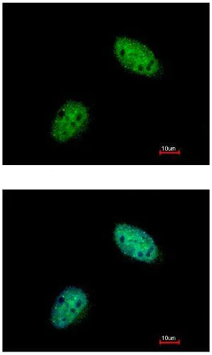 Immunocytochemistry/ Immunofluorescence - Anti-Exonuclease 1 antibody (AB155553)