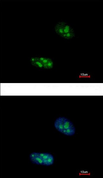 Immunocytochemistry/ Immunofluorescence - Anti-EXOSC10/RRP6 antibody (AB154239), expandable thumbnail