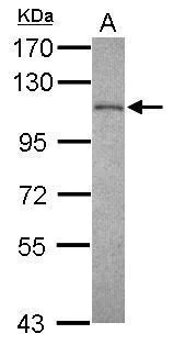 Western blot - Anti-EXOSC10/RRP6 antibody (AB154239)