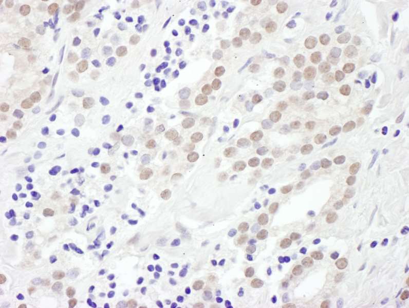 Immunohistochemistry (Formalin/PFA-fixed paraffin-embedded sections) - Anti-EXOSC10/RRP6 antibody (AB264343)