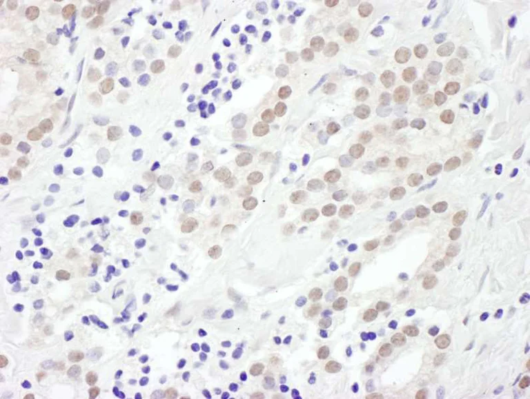 Immunohistochemistry (Formalin/PFA-fixed paraffin-embedded sections) - Anti-EXOSC10/RRP6 antibody (AB264343)