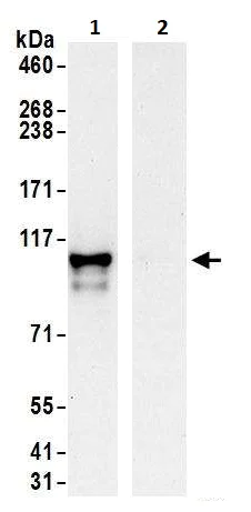 Immunoprecipitation - Anti-EXOSC10/RRP6 antibody (AB264343)