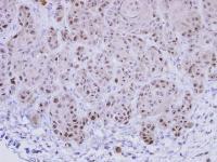 Immunohistochemistry (Formalin/PFA-fixed paraffin-embedded sections) - Anti-EXOSC10/RRP6 antibody (AB94981)