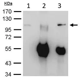 Immunoprecipitation - Anti-EXOSC10/RRP6 antibody (AB94981)