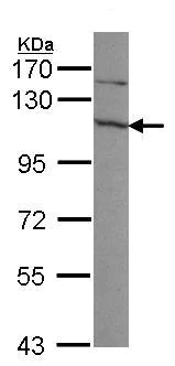 Western blot - Anti-EXOSC10/RRP6 antibody (AB94981)