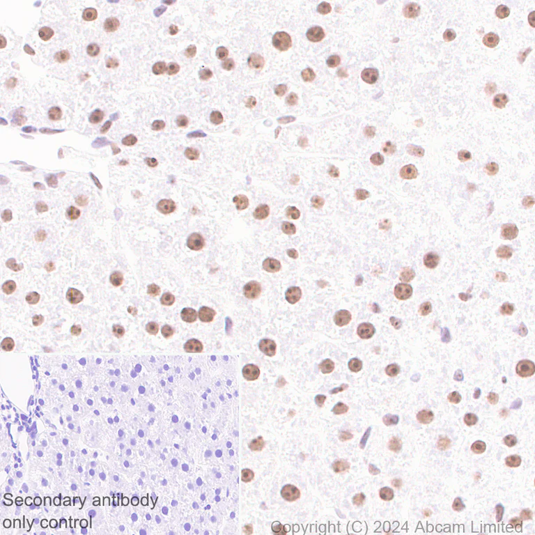 Immunohistochemistry (Formalin/PFA-fixed paraffin-embedded sections) - Anti-EXOSC10/RRP6 antibody [EPR28902-62] (AB319992)