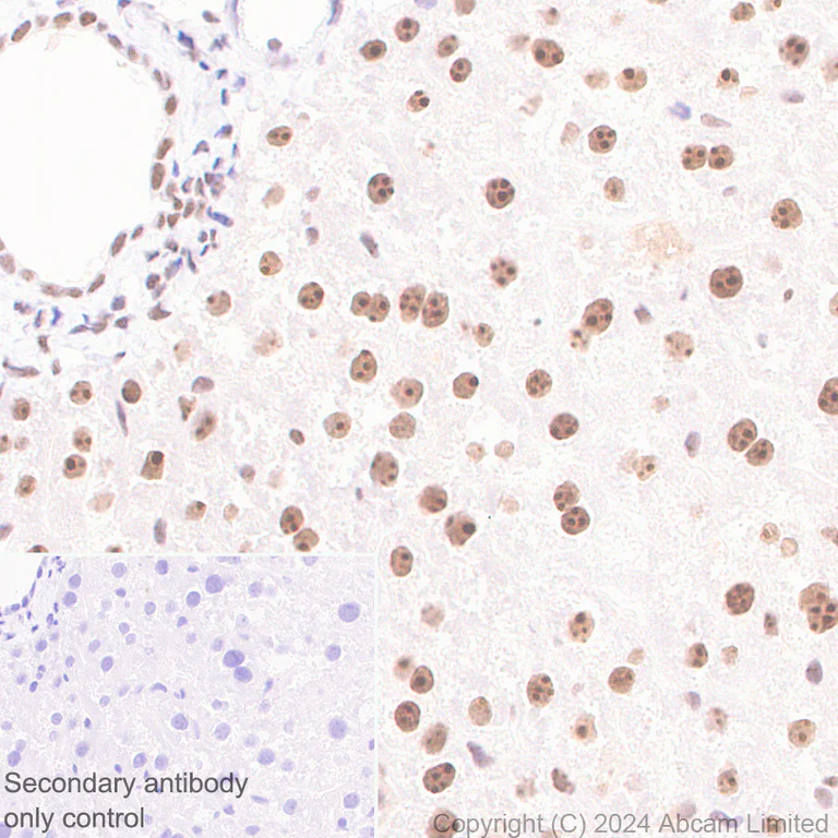 Immunohistochemistry (Formalin/PFA-fixed paraffin-embedded sections) - Anti-EXOSC10/RRP6 antibody [EPR28902-62] (AB319992)