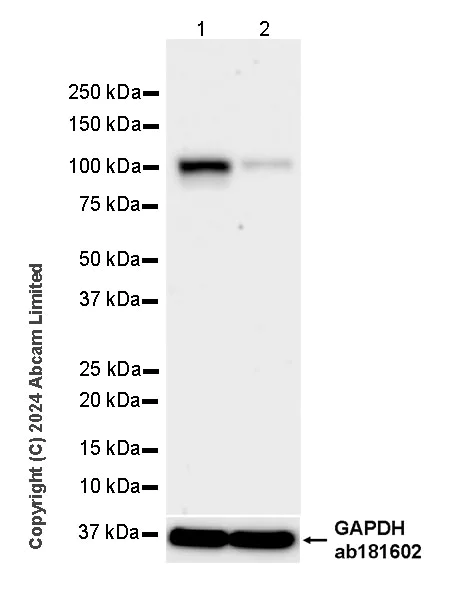 Western blot - Anti-EXOSC10/RRP6 antibody [EPR28902-62] (AB319992)