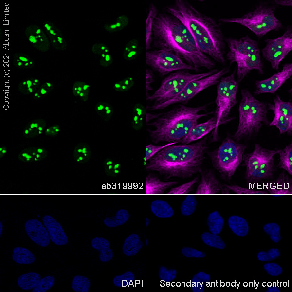Immunocytochemistry/ Immunofluorescence - Anti-EXOSC10/RRP6 antibody [EPR28902-62] - BSA and Azide free (AB319993), expandable thumbnail