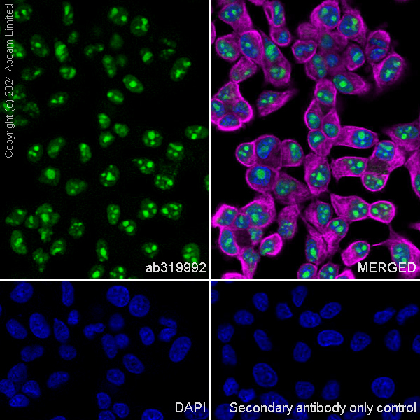 Immunocytochemistry/ Immunofluorescence - Anti-EXOSC10/RRP6 antibody [EPR28902-62] - BSA and Azide free (AB319993), expandable thumbnail