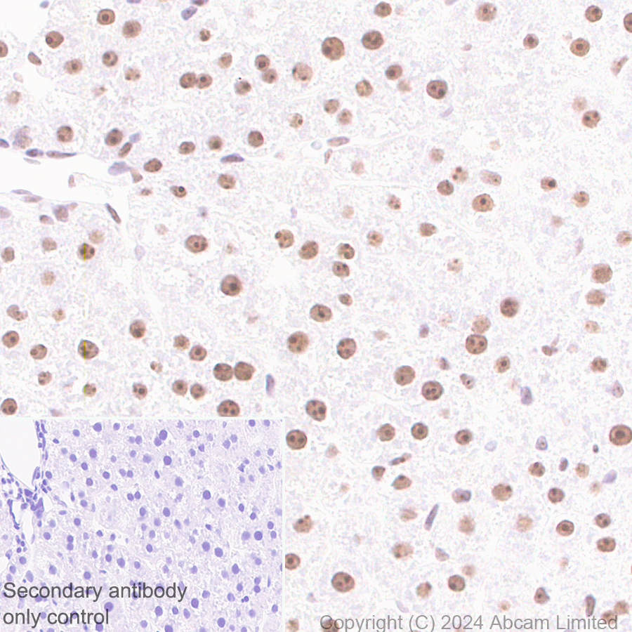 Immunohistochemistry (Formalin/PFA-fixed paraffin-embedded sections) - Anti-EXOSC10/RRP6 antibody [EPR28902-62] - BSA and Azide free (ab319993), expandable thumbnail