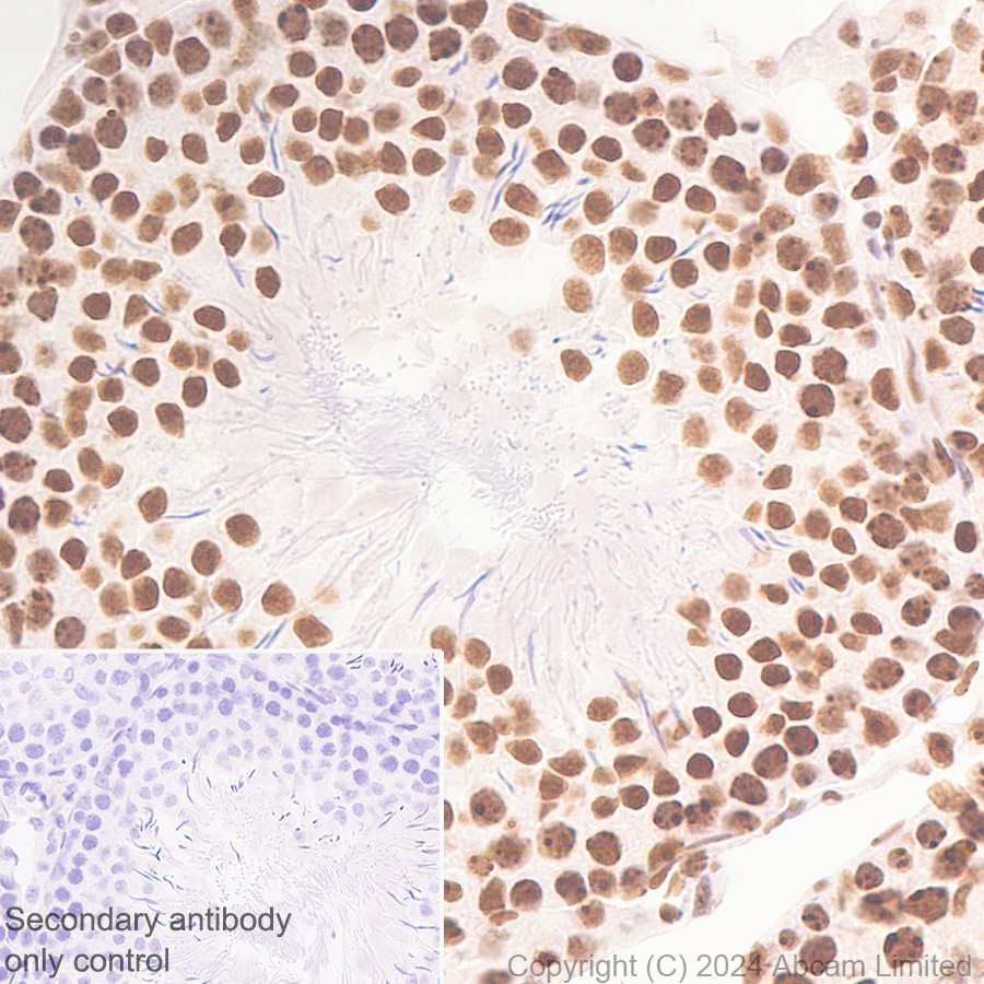 Immunohistochemistry (Formalin/PFA-fixed paraffin-embedded sections) - Anti-EXOSC10/RRP6 antibody [EPR28902-62] - BSA and Azide free (ab319993), expandable thumbnail