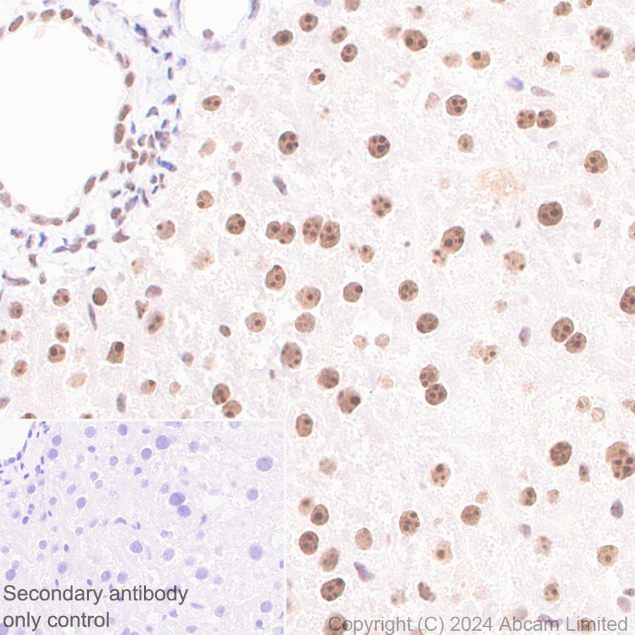 Immunohistochemistry (Formalin/PFA-fixed paraffin-embedded sections) - Anti-EXOSC10/RRP6 antibody [EPR28902-62] - BSA and Azide free (ab319993), expandable thumbnail