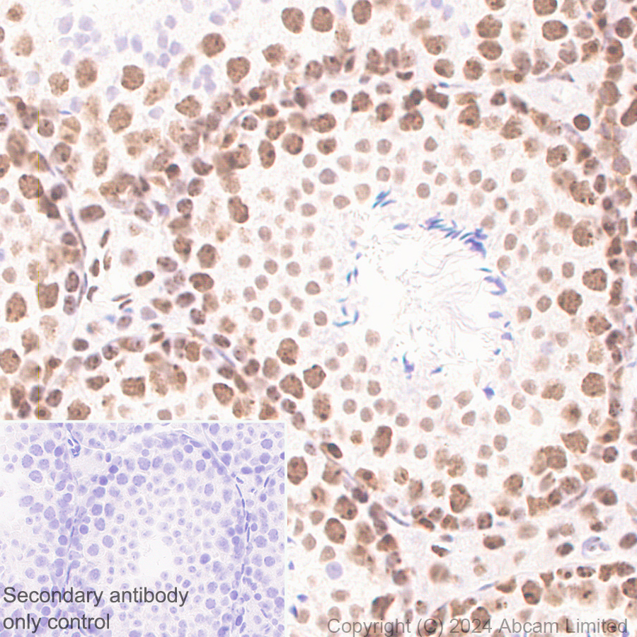 Immunohistochemistry (Formalin/PFA-fixed paraffin-embedded sections) - Anti-EXOSC10/RRP6 antibody [EPR28902-62] - BSA and Azide free (ab319993), expandable thumbnail