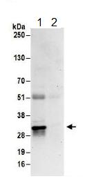 Immunoprecipitation - Anti-EXOSC3 antibody (AB156683), expandable thumbnail