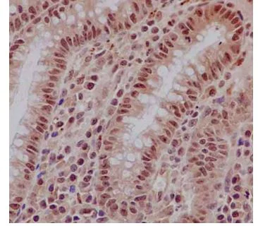 Immunohistochemistry (Formalin/PFA-fixed paraffin-embedded sections) - Anti-EXOSC3 antibody [EPR14840(B)] - BSA and Azide free (AB250797)
