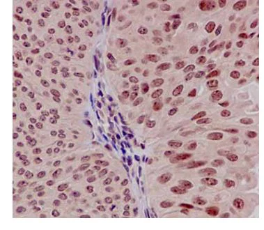 Immunohistochemistry (Formalin/PFA-fixed paraffin-embedded sections) - Anti-EXOSC3 antibody [EPR14840(B)] - BSA and Azide free (AB250797)