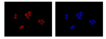 Immunocytochemistry/ Immunofluorescence - Anti-EXOSC3 antibody [EPR14840(B)] - N-terminal (AB184961)