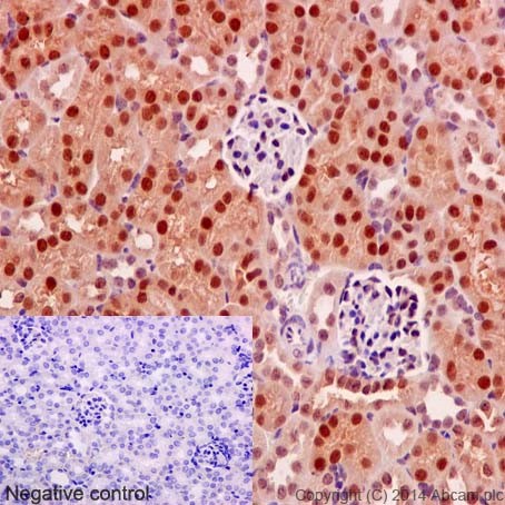 Immunohistochemistry (Formalin/PFA-fixed paraffin-embedded sections) - Anti-EXOSC3 antibody [EPR14841] - C-terminal (AB190689), expandable thumbnail