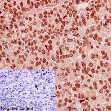 Immunohistochemistry (Formalin/PFA-fixed paraffin-embedded sections) - Anti-EXOSC3 antibody [EPR14841] - C-terminal (AB190689), expandable thumbnail