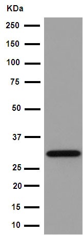 Western blot - Anti-EXOSC3 antibody [EPR14841] - C-terminal (ab190689), expandable thumbnail
