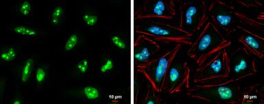 Immunocytochemistry/ Immunofluorescence - Anti-EXOSC5/CML28 antibody (AB154718), expandable thumbnail